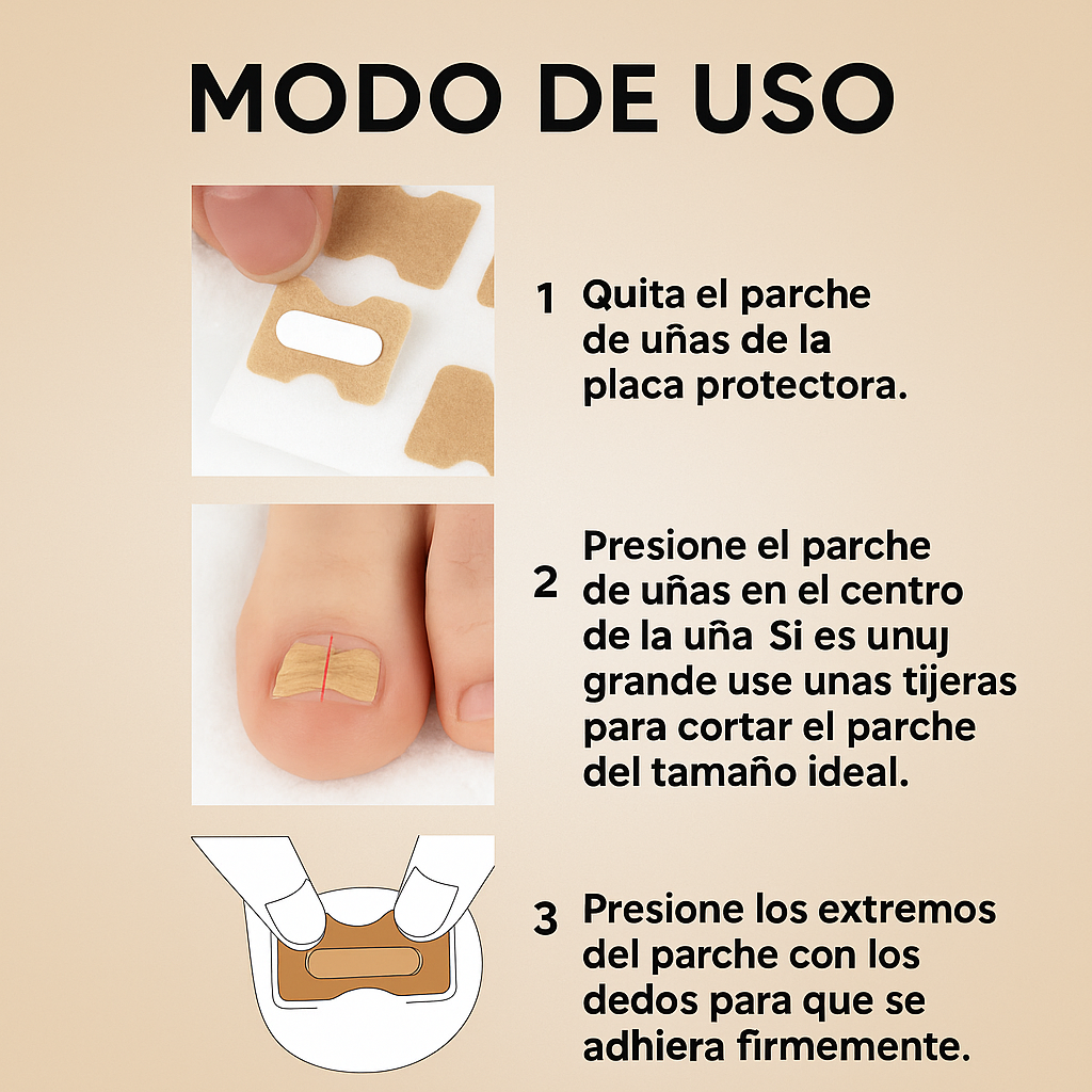 NailRelief™ – Pack por 3 cajas Corrector para Uñas Encarnadas